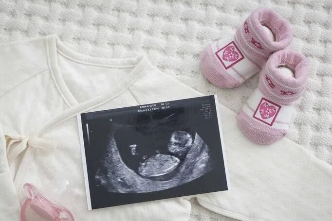 Obesity on In Vitro Fertility