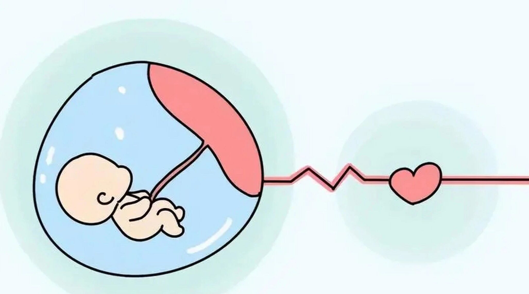 IVF Embryo Transfer